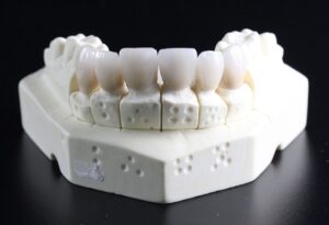 dental